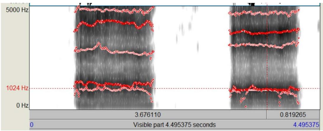 F2 difference when /a/ is produced with a forward versus a retracted tongue position