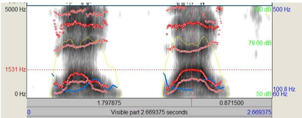 ワオ・トレーニングでの通常の口の形と、口角を広げた状態のF2の比較